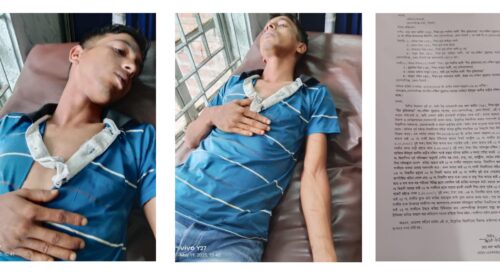 কোম্পানীগঞ্জে যুবককে কুপিয়ে আহত : থানায় অভিযোগ